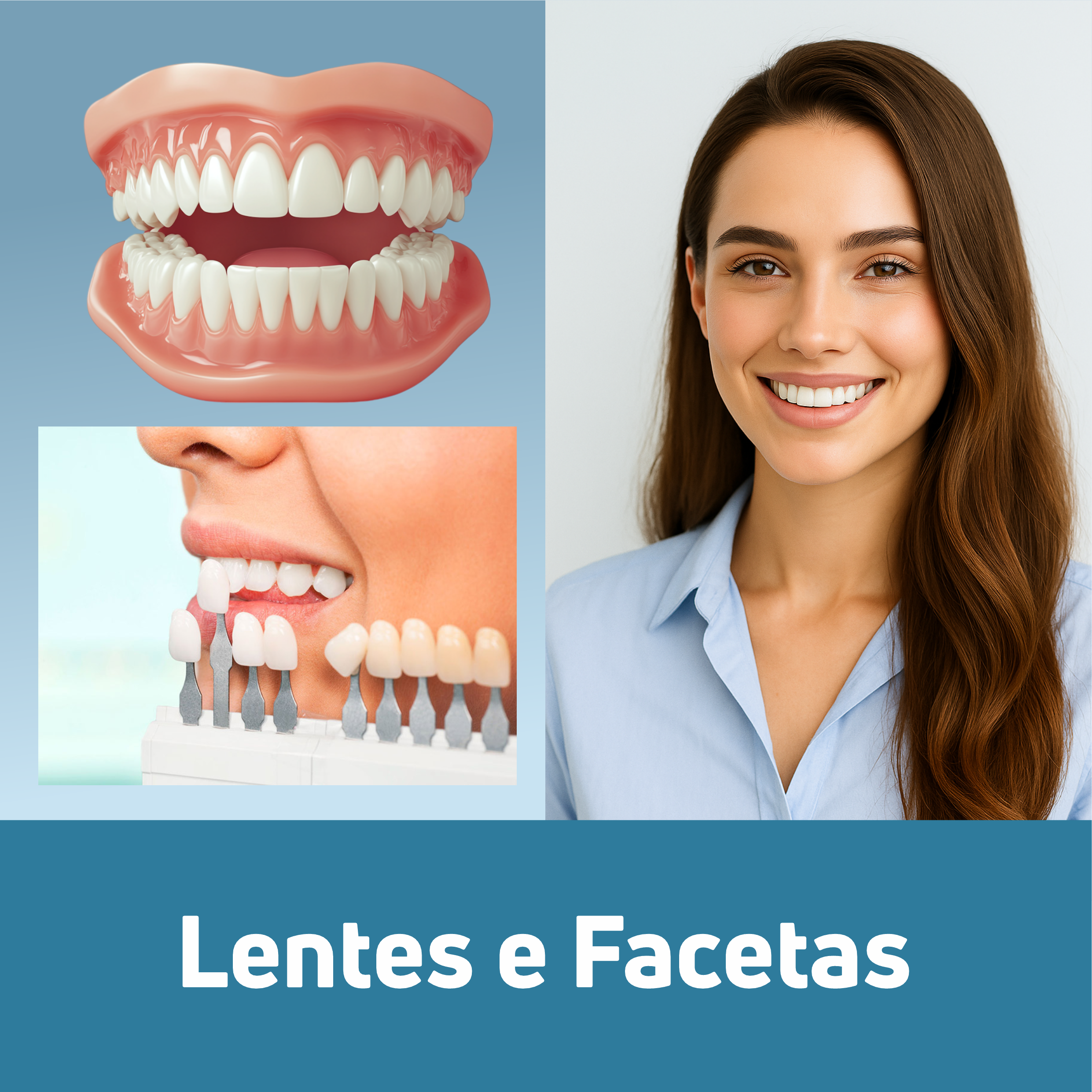 Lentes e Facetas
